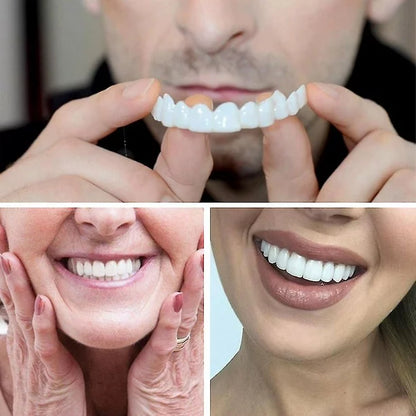✨ Carillas SmileFlex™: belleza instantánea para tus dientes